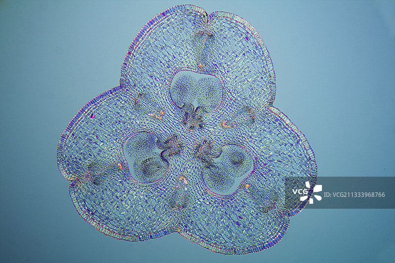 卵巢截面图图片素材