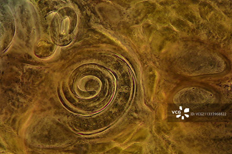 这种蠕虫会导致可怕的旋毛虫病。人们因食用未煮熟的猪肉而感染图片素材