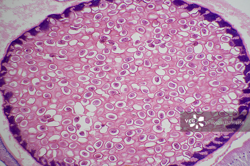 蛔虫在输卵管中的横截面图片素材