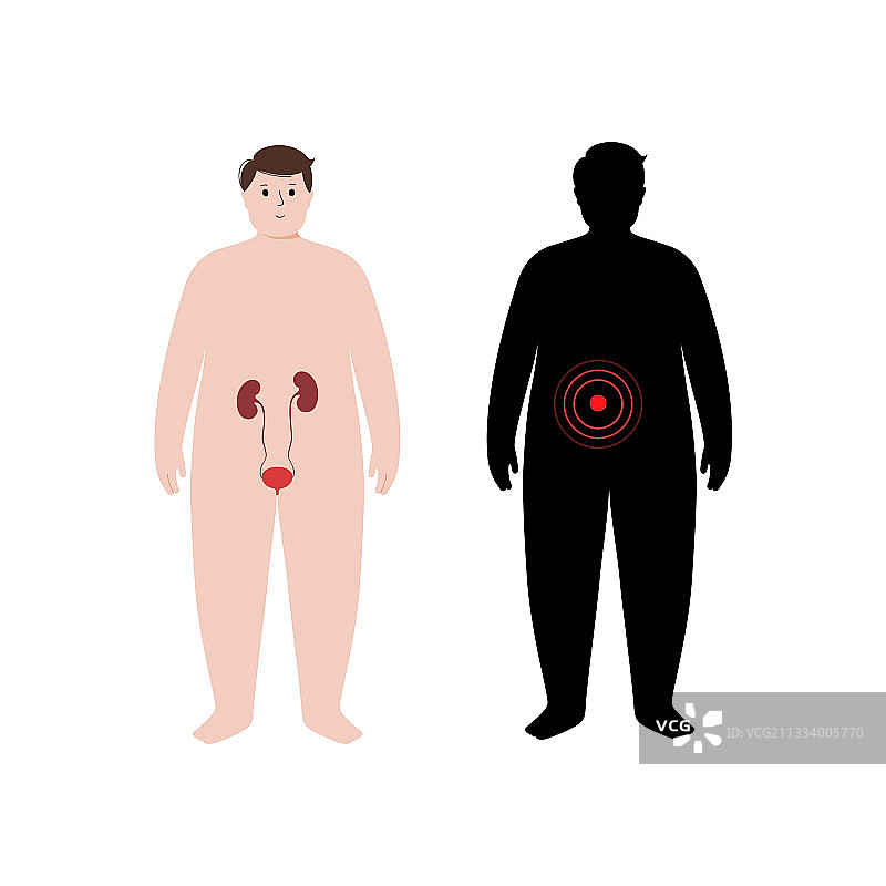 肥胖人体内的器官图片素材