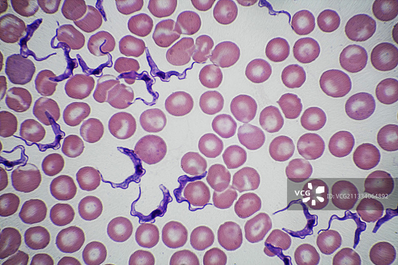 明亮背景下的照明，放大1000倍。这种鞭毛寄生虫是苏拉病的原因，苏拉病会影响非洲的不同哺乳动物，如骆驼、水牛等图片素材