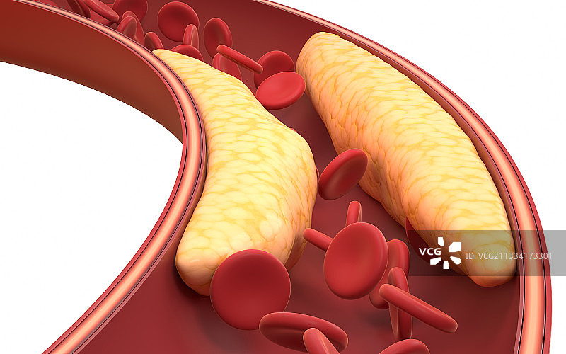 血管中的脂肪与红细胞 3D渲染图片素材
