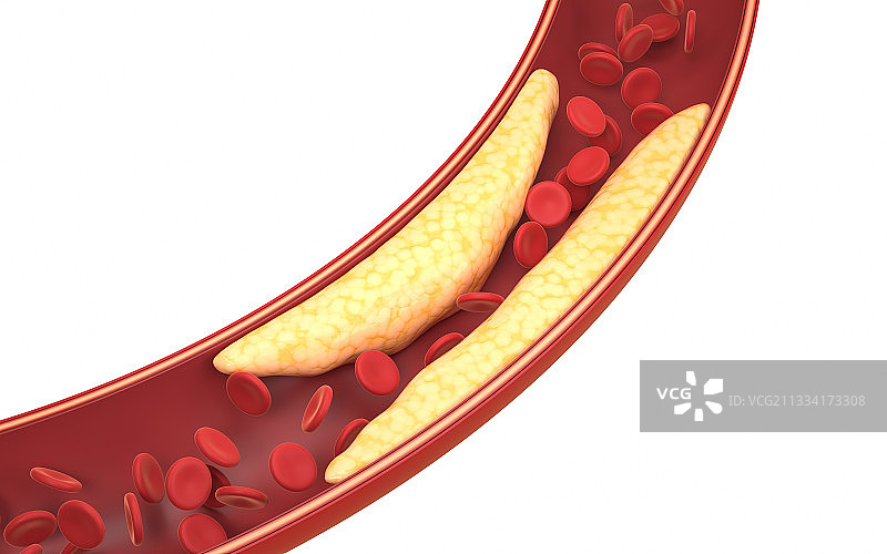 血管中的脂肪与红细胞 3D渲染图片素材