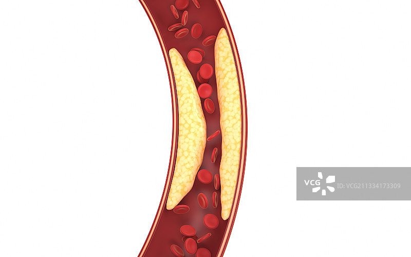 血管中的脂肪与红细胞 3D渲染图片素材