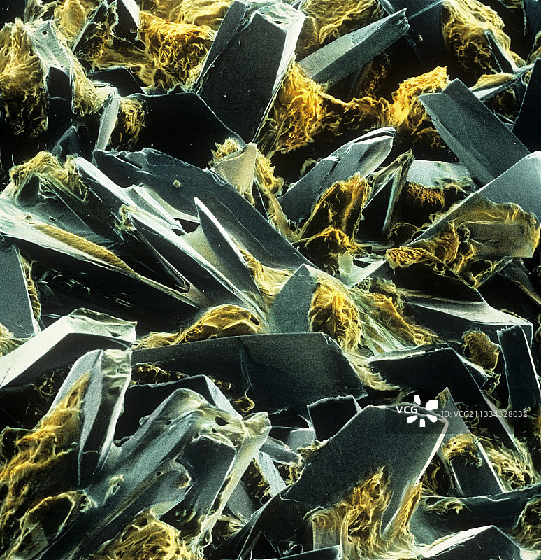 葡萄糖晶体的伪色彩扫描电镜图图片素材