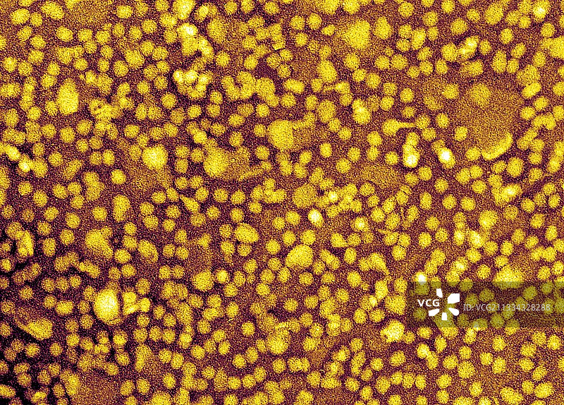 低密度脂蛋白，TEM图片素材