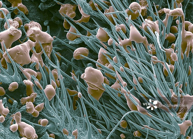 大麻药物树脂，扫描电子显微镜图片素材