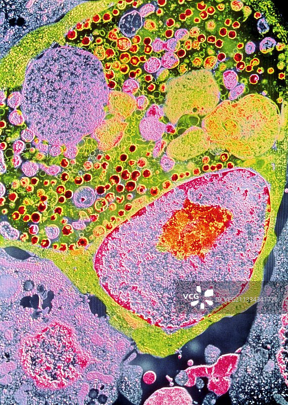 衣原体细菌的彩色透射电镜图图片素材