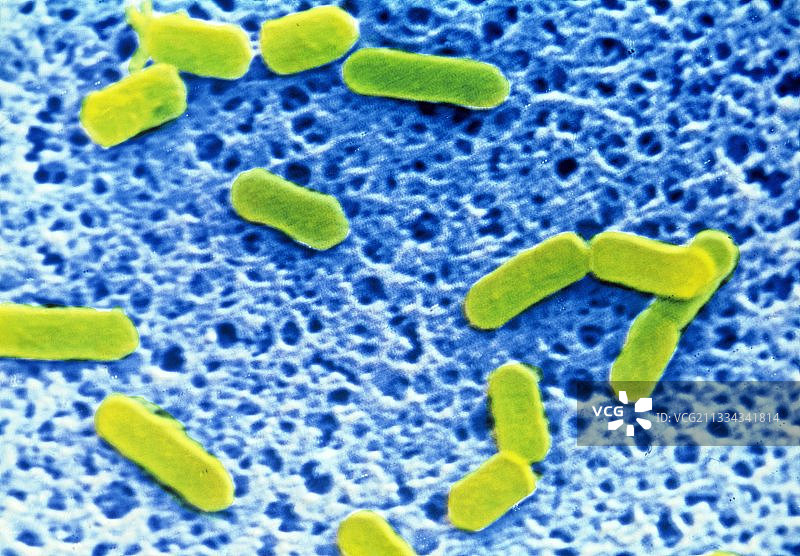 李斯特菌的彩色扫描电镜图片素材