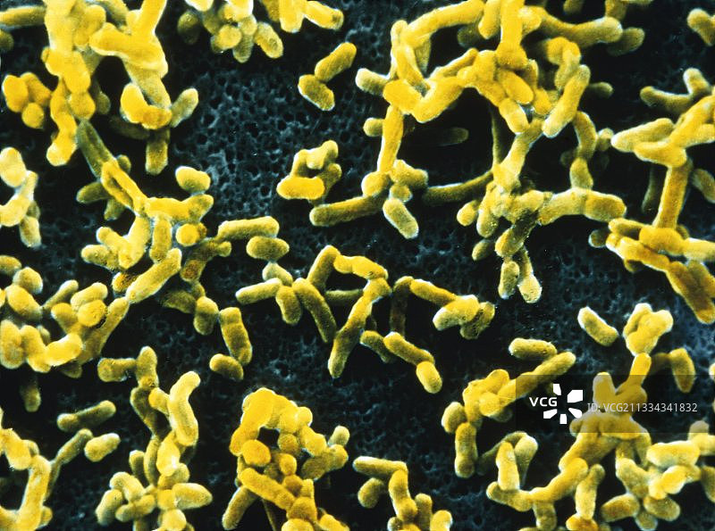 鼠疫耶尔森菌细菌的彩色扫描电镜图片素材