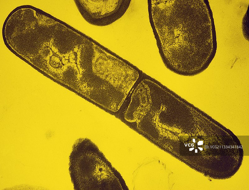 枯草芽孢杆菌的透射电镜图片素材