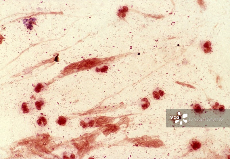 流感嗜血杆菌细菌的显微图图片素材