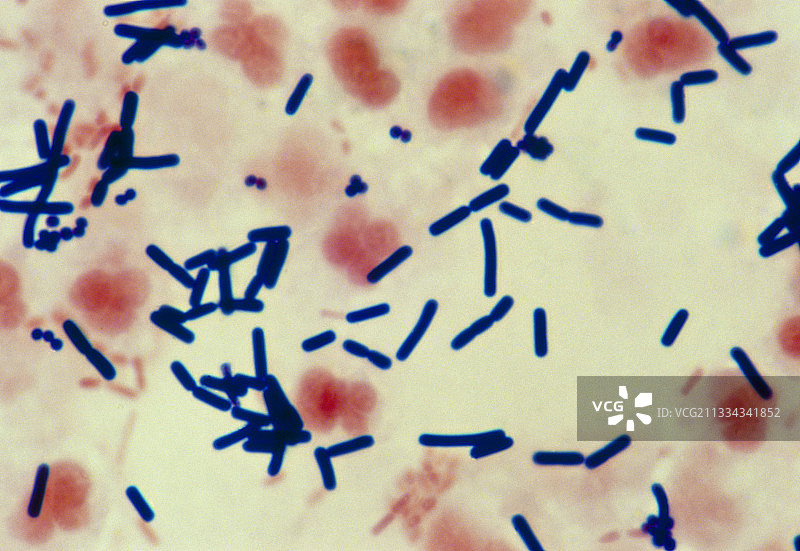 伤口中的产气荚膜梭菌图片素材