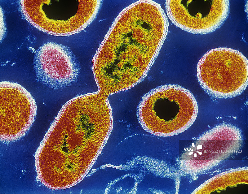 单核细胞增生李斯特氏菌的彩色透射电镜图片素材