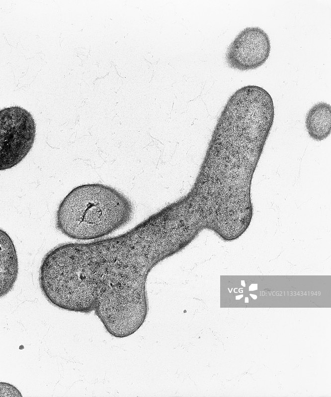 双歧杆菌的透射电镜图片素材