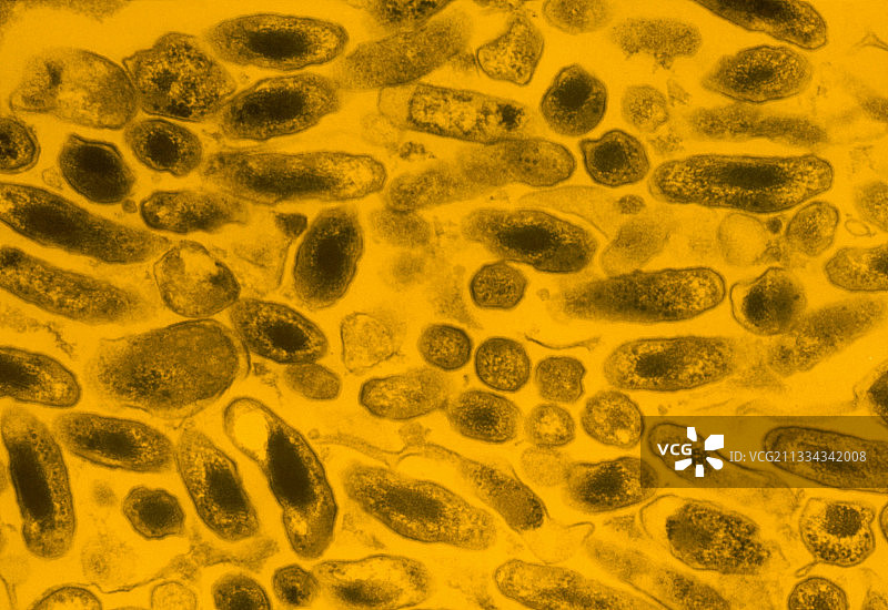 伯氏考克斯体假彩色透射电镜图图片素材