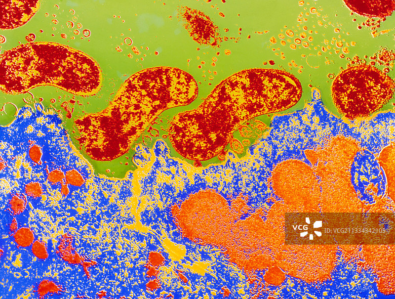 幽门螺杆菌的透射电镜图片素材