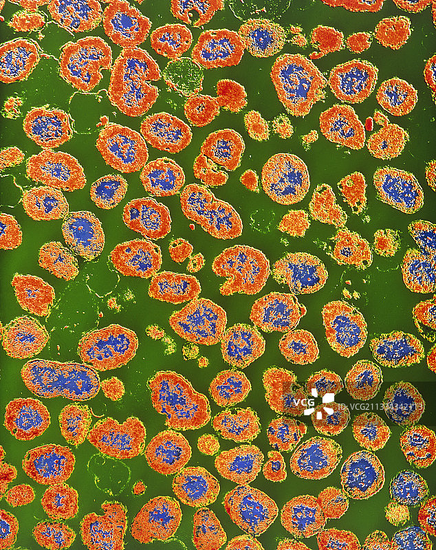 淋病奈瑟菌图片素材