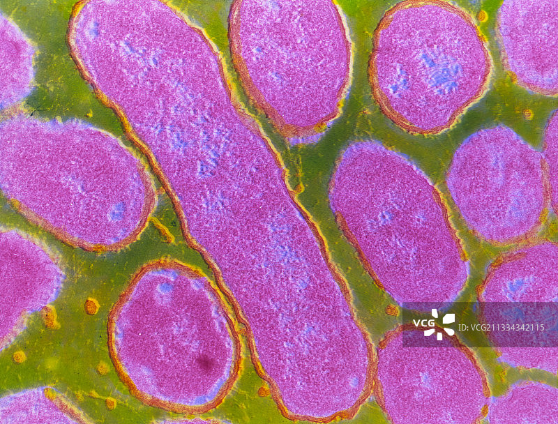 流感嗜血杆菌TEM的彩色透射电镜图片素材