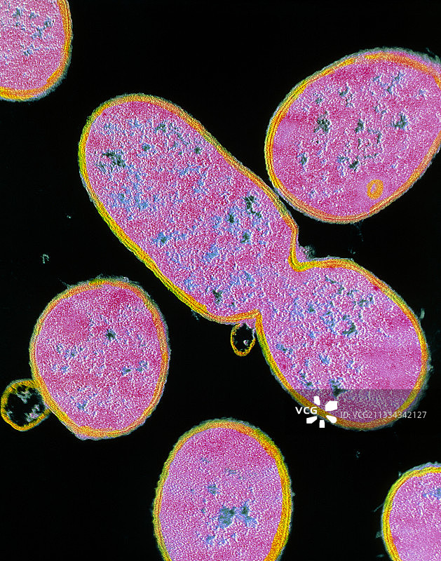 志贺氏菌细菌的透射电镜图片素材