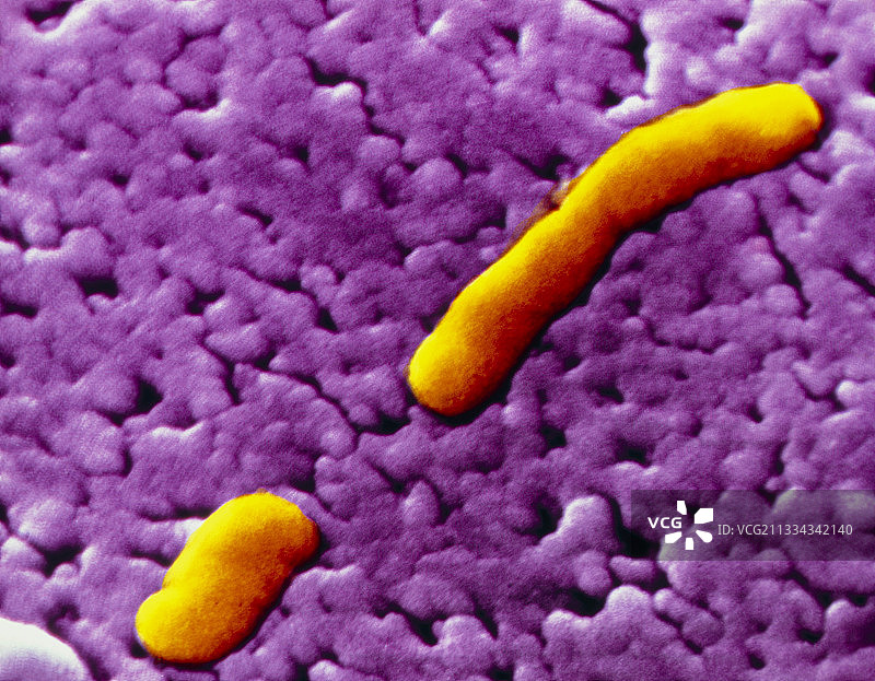 流感嗜血杆菌图片素材