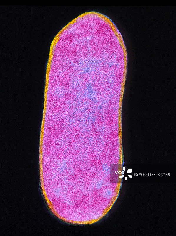 伤寒沙门氏菌的透射电镜照片图片素材