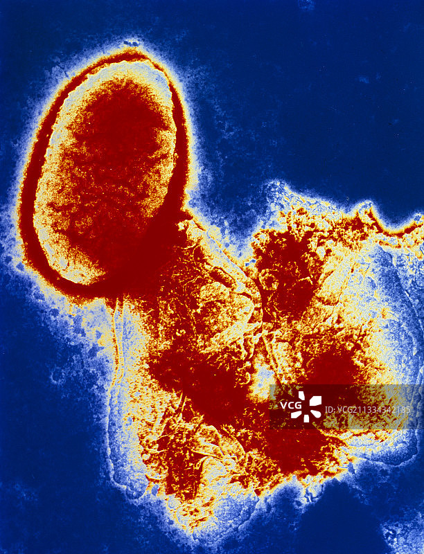 流感嗜血杆菌图片素材