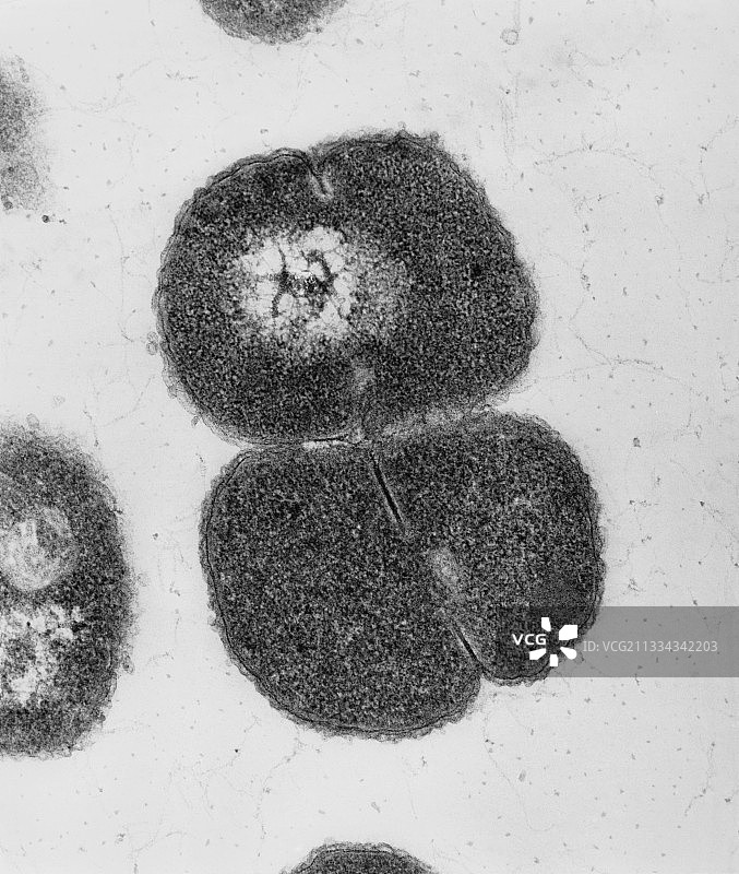 脑膜炎奈瑟菌细菌的透射电镜图片素材