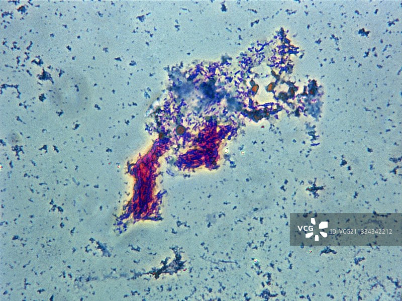 结核分枝杆菌图片素材