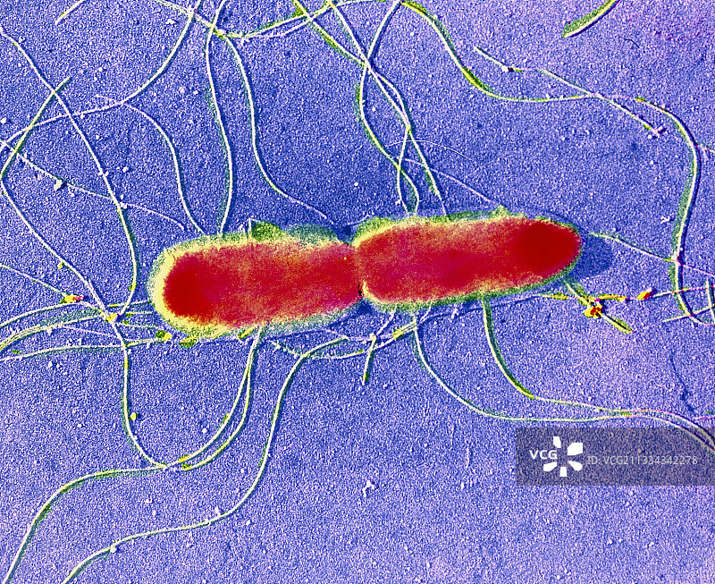 伤寒沙门氏菌的伪彩色透射电镜图图片素材