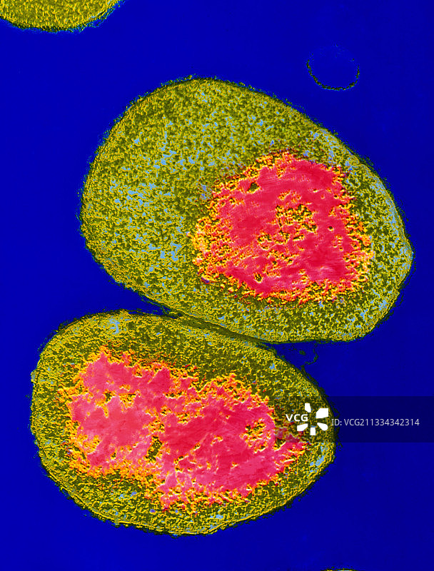 脑膜炎奈瑟菌图片素材
