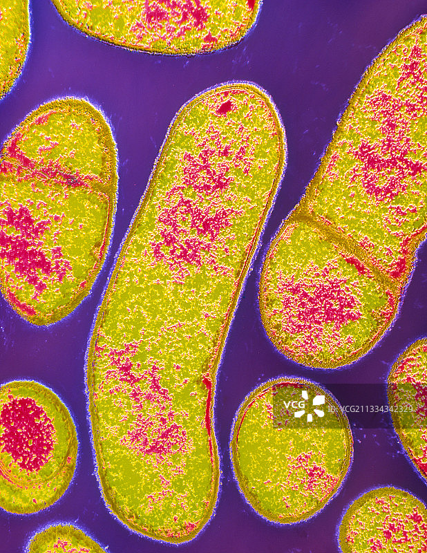 肉毒梭菌的伪彩色透射电镜图图片素材