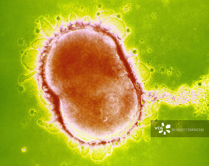 脑膜炎奈瑟菌图片素材