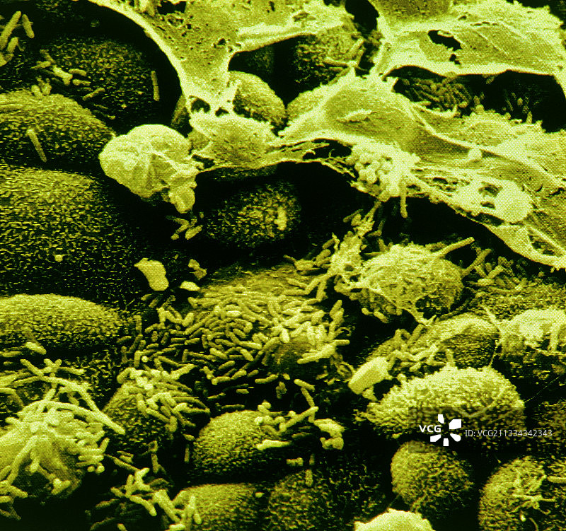 流感嗜血杆菌图片素材