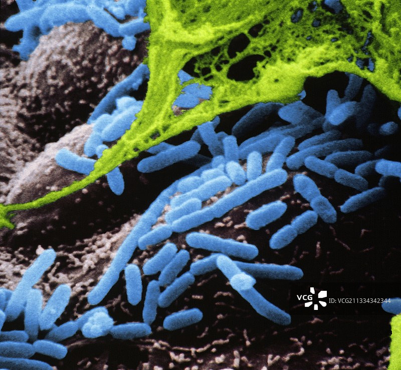 流感嗜血杆菌的扫描电子显微镜照片图片素材
