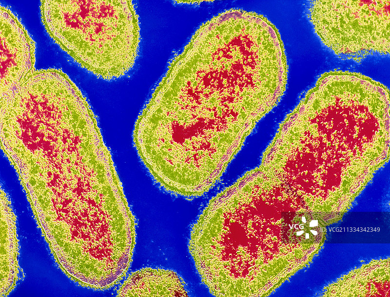 牙龈卟啉单胞菌图片素材