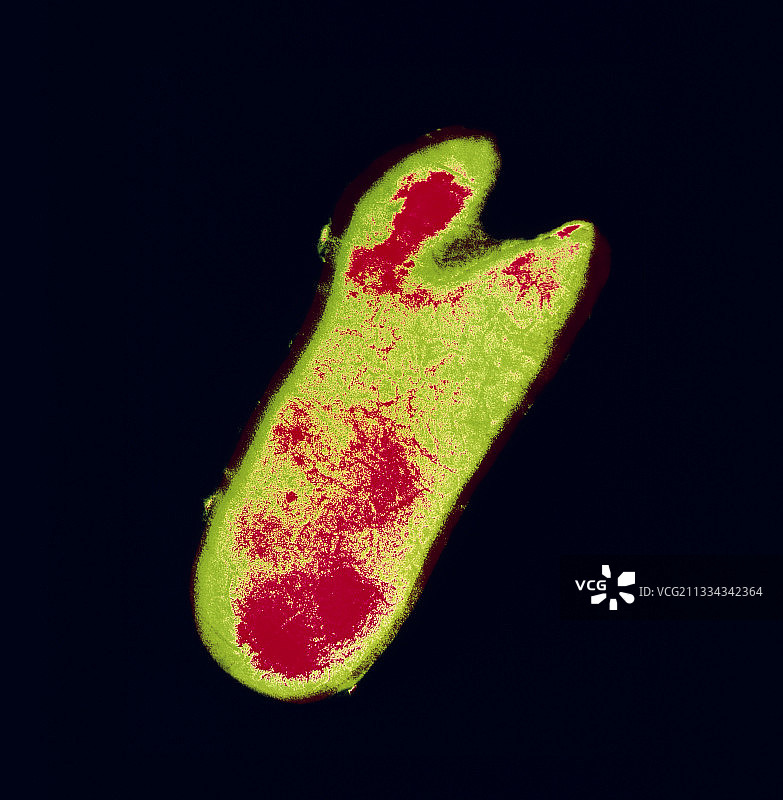 结核分枝杆菌图片素材