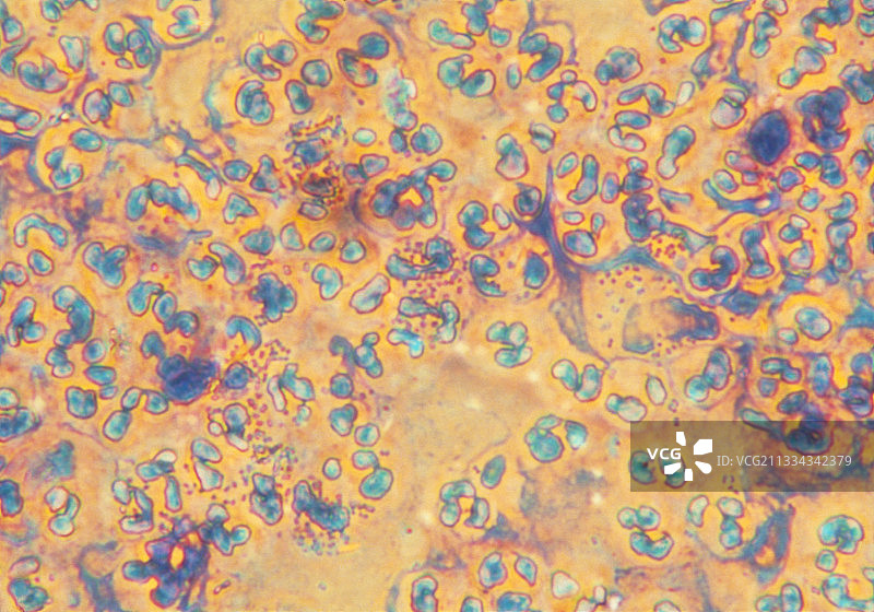 淋病奈瑟菌图片素材