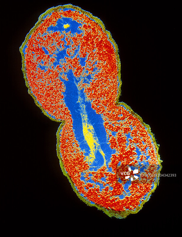 流感嗜血杆菌的彩色透射电镜图像图片素材