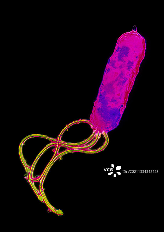幽门螺杆菌图片素材