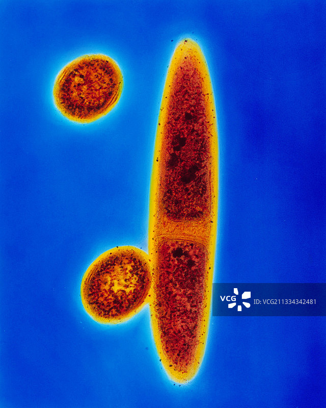 匈牙利甲烷螺菌古生菌图片素材