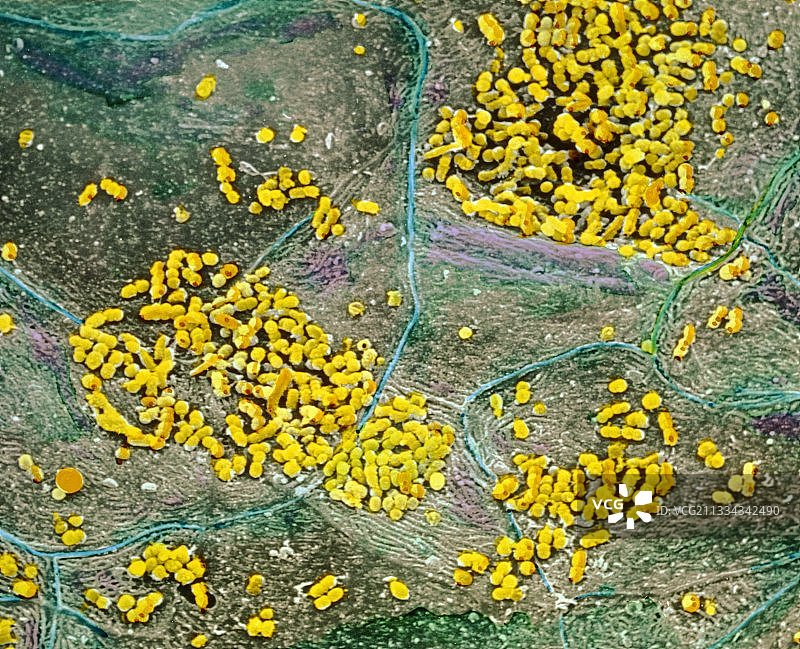 舌头表面的细菌图片素材