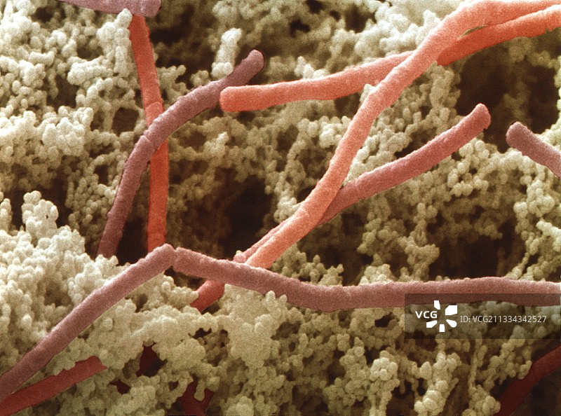 保加利亚乳杆菌的扫描电子显微镜图像图片素材