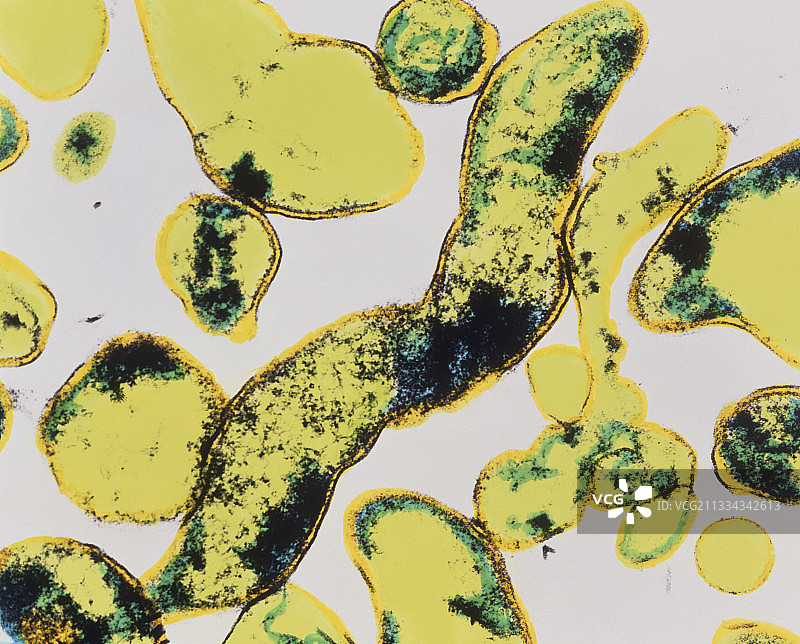 幽门螺杆菌图片素材