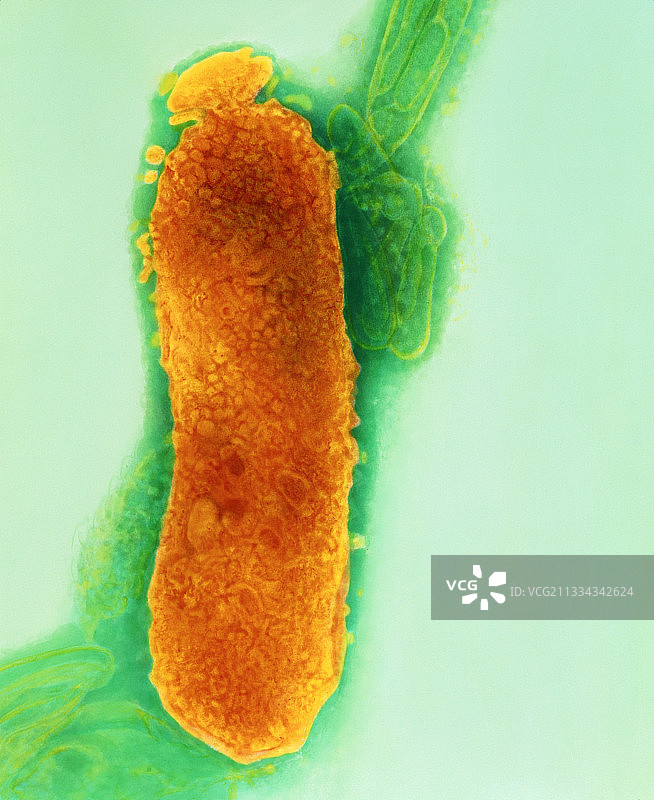 坏死梭杆菌的透射电镜照片图片素材