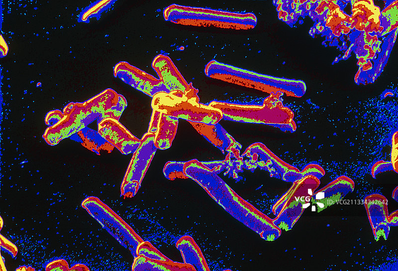 破伤风梭菌图片素材