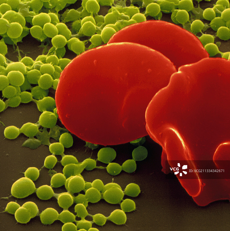 卡他莫拉菌图片素材