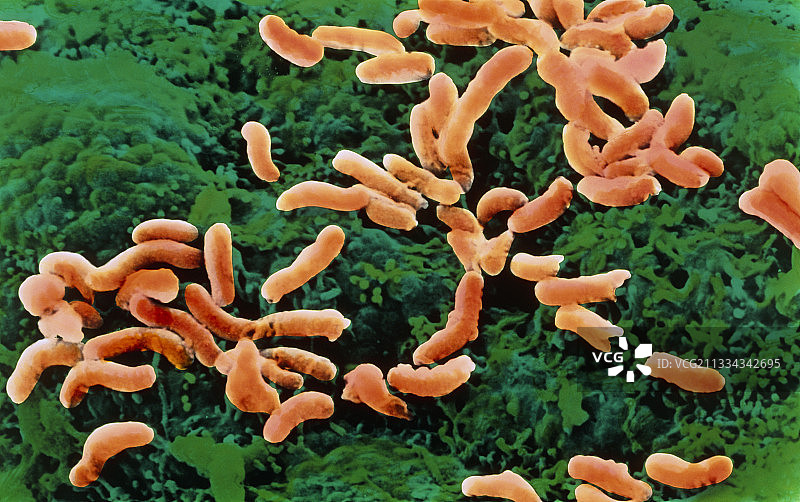 幽门螺杆菌图片素材