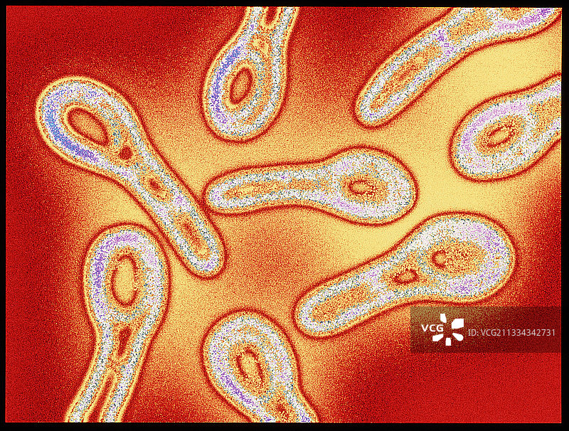 棒状杆菌透射电镜图像图片素材