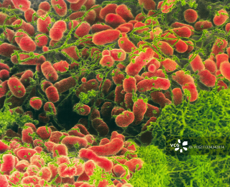 放线杆菌细菌簇的扫描电镜图图片素材